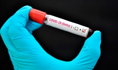 Exclusivo: pesquisan primer caso de variante Delta de Covid-19 en Linares