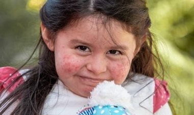 Linares: inaugurarán parque en homenaje a la pequeña Andrea “Lulú” Santos