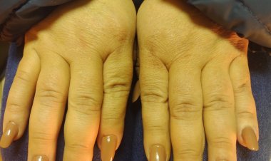 El silencio sepulcral del SernamEG ante la denuncia por malos tratos al interior de Casa de Acogida para víctimas de Violencia Intrafamiliar en Linares