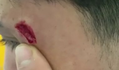 Linares: agreden a guardia y técnico paramédico del SAR del CESFAM San Juan de Dios