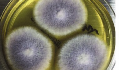 Hongo Fusarium Solani: ¿Qué es y cómo afecta a las personas?