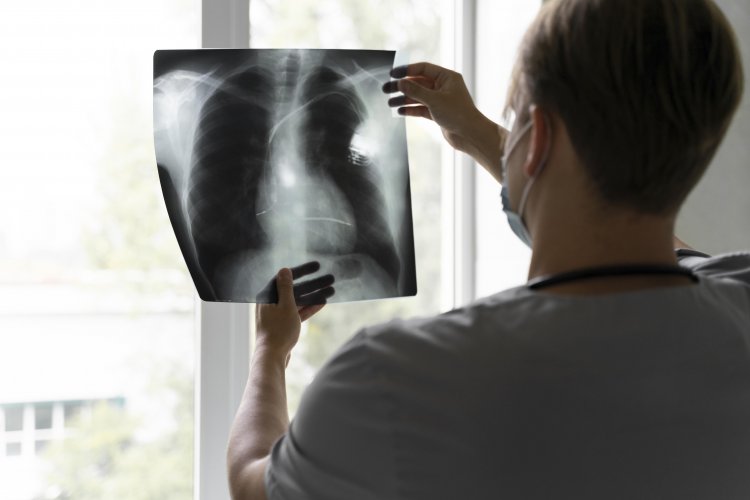 Enfermedad Pulmonar Obstructiva Crónica: cuáles son sus causas y riesgos