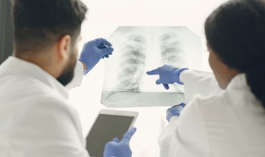 Tuberculosis: Cómo se transmite y cuáles son sus síntomas