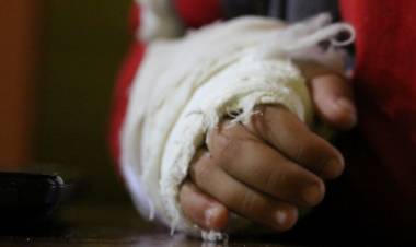 Menor se resbala y sufre grave fractura en su brazo