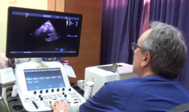 Área de cardiología del hospital de Linares compra moderno eco-cardiógrafo 