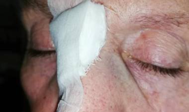 Adulta mayor sufre fuerte caída por mal estado de veredas en el centro de Linares