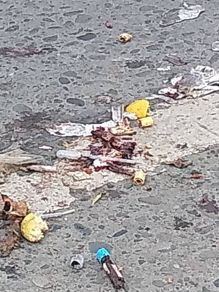 Autoridad investiga aparición de material biológico en el centro de Linares