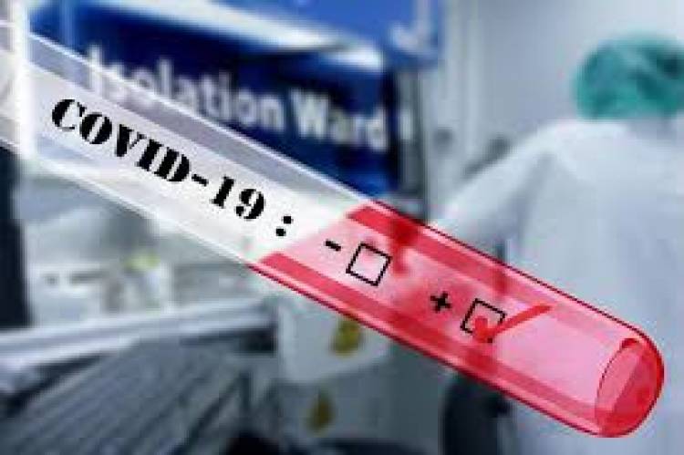 Coronavirus: 50 nuevos contagios y 340 personas en condición activa en Linares